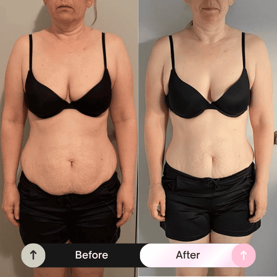 Before and after transformation
