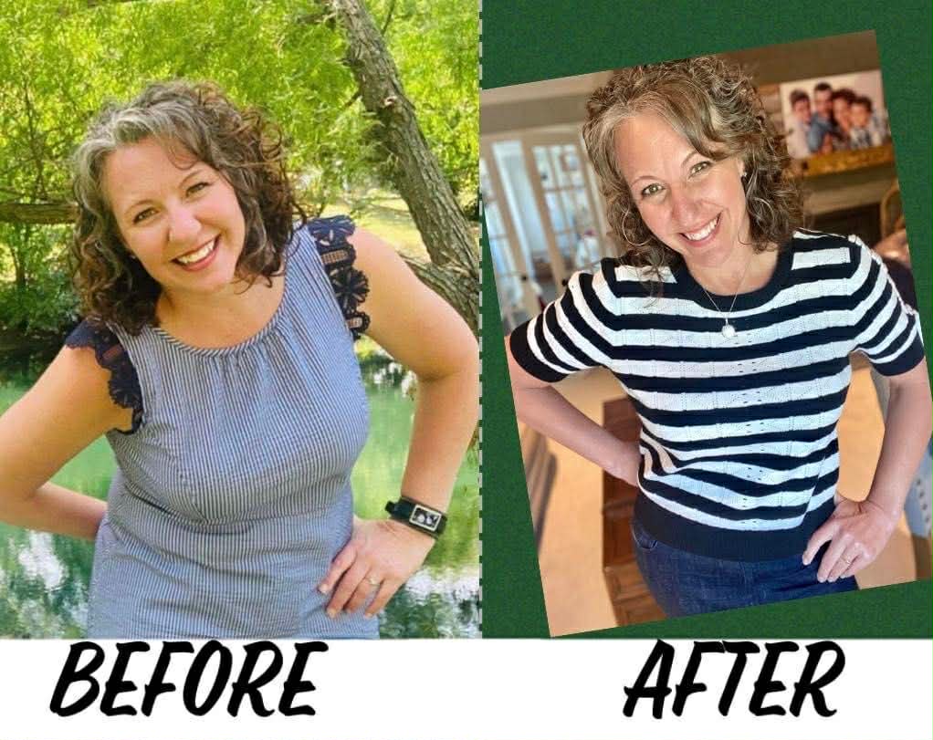 Amy Myers before and after