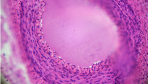 What Bartonella Does in the Body: The Physiology What Bartonella Does in the Body: The Physiology