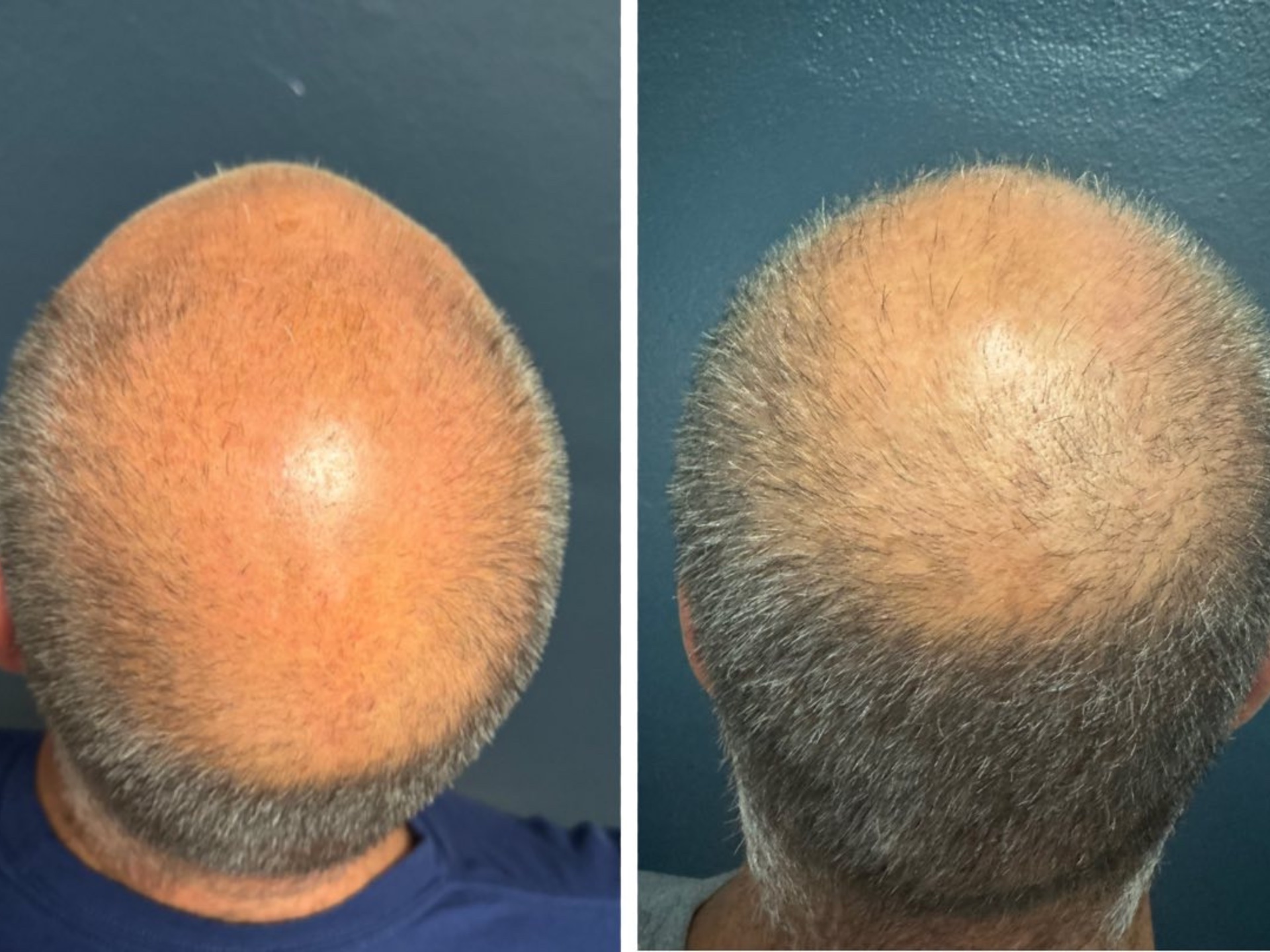 Patient Result 2