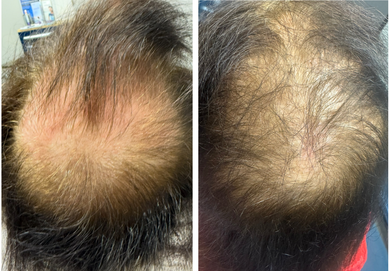 Patient Result 4
