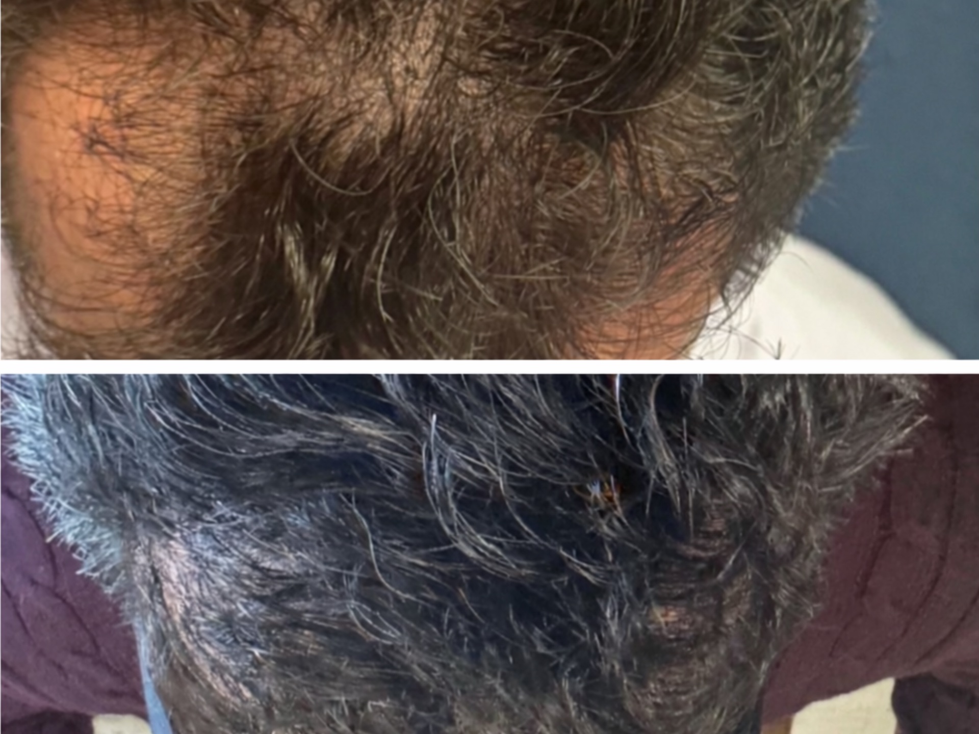 Patient Result 3