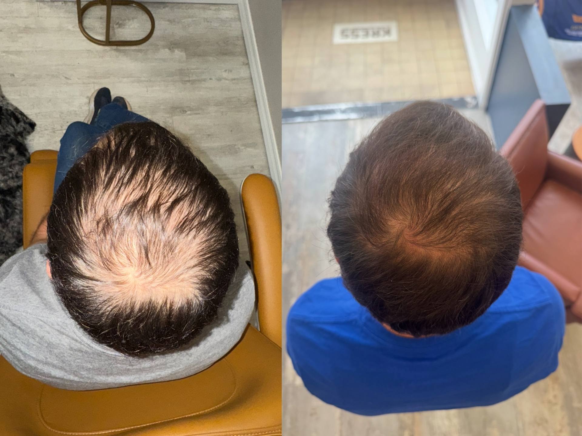 Patient Result 6