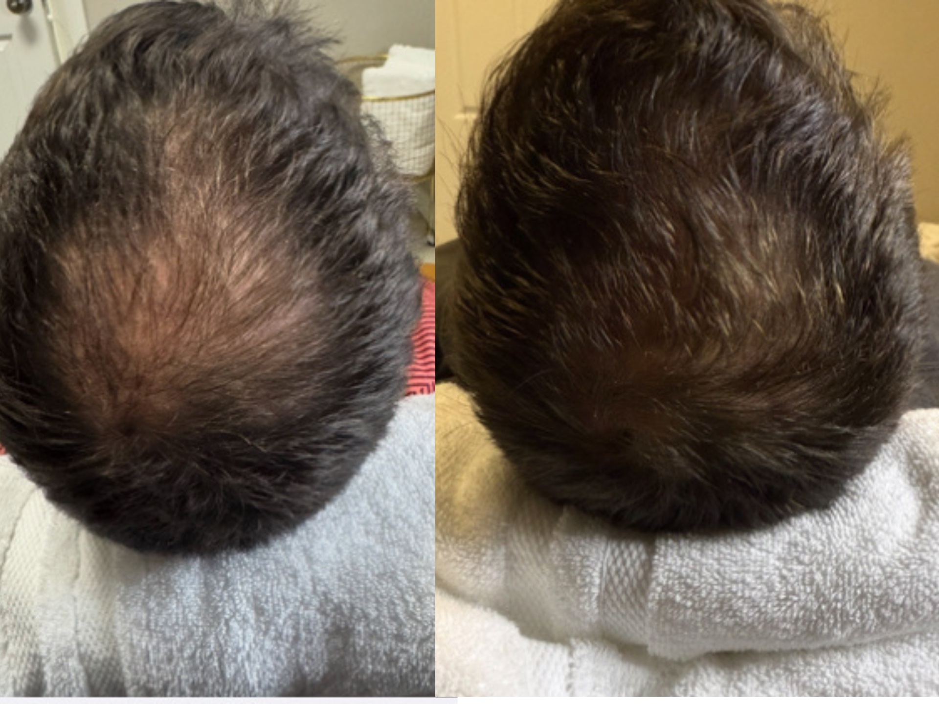 Patient Result 5