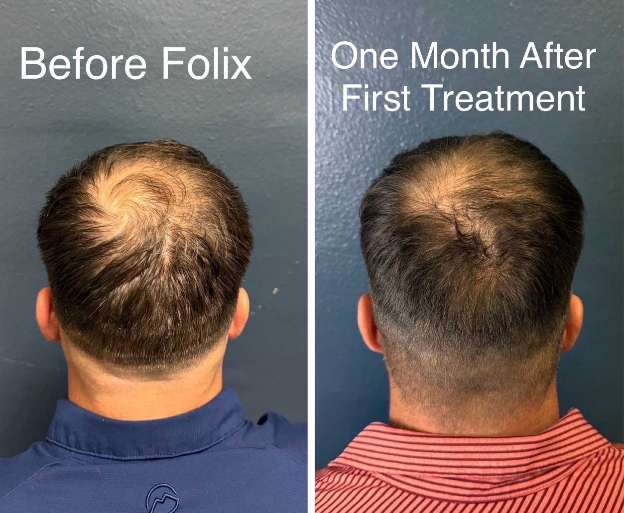 Patient Result 1
