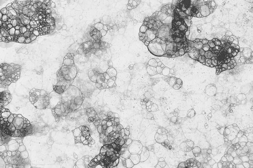 Oxidative Stress