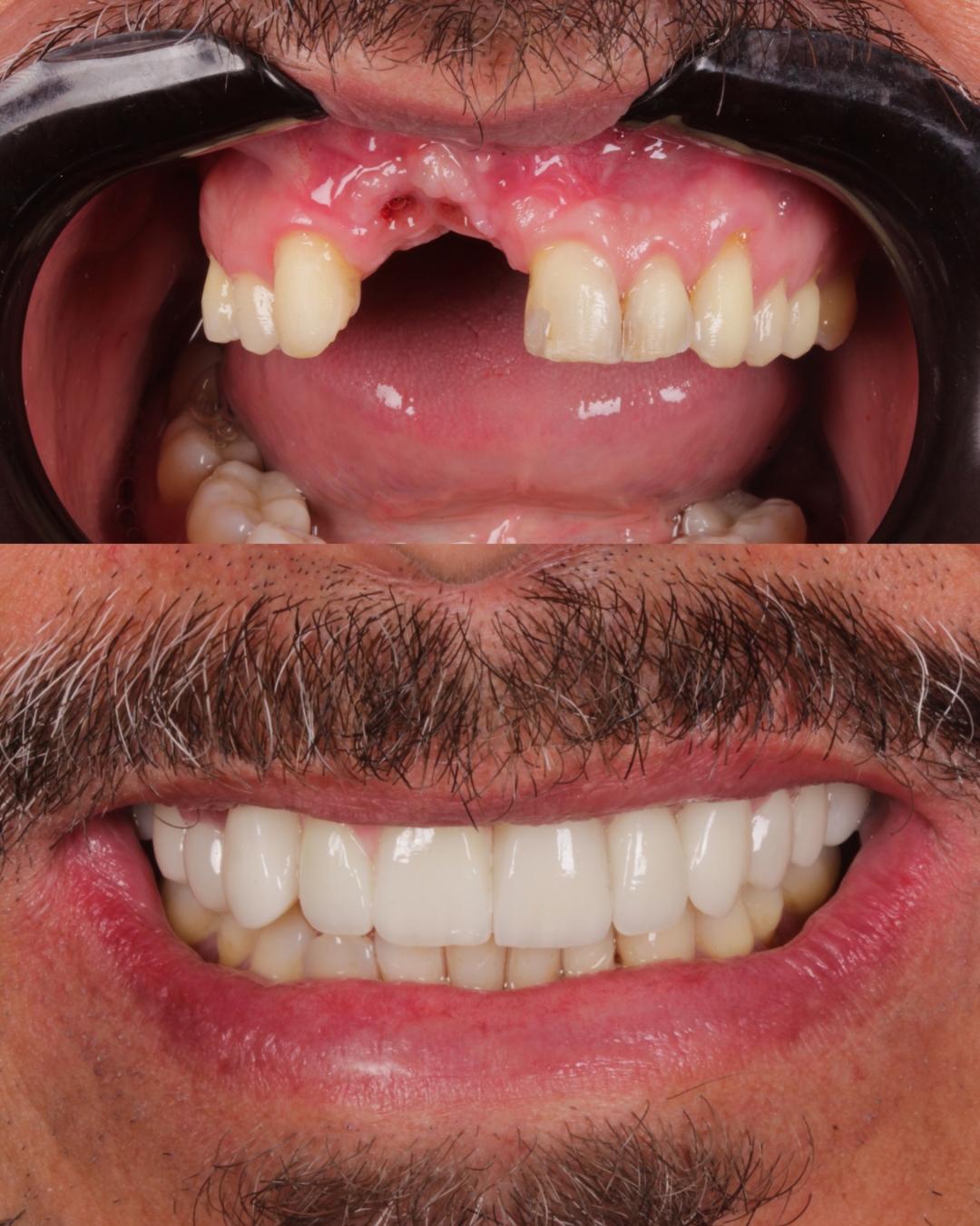 Resultado del tratamiento de Orlando