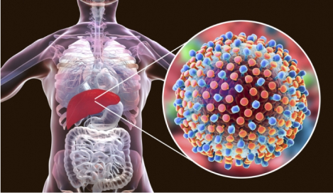 hepatitis-explained