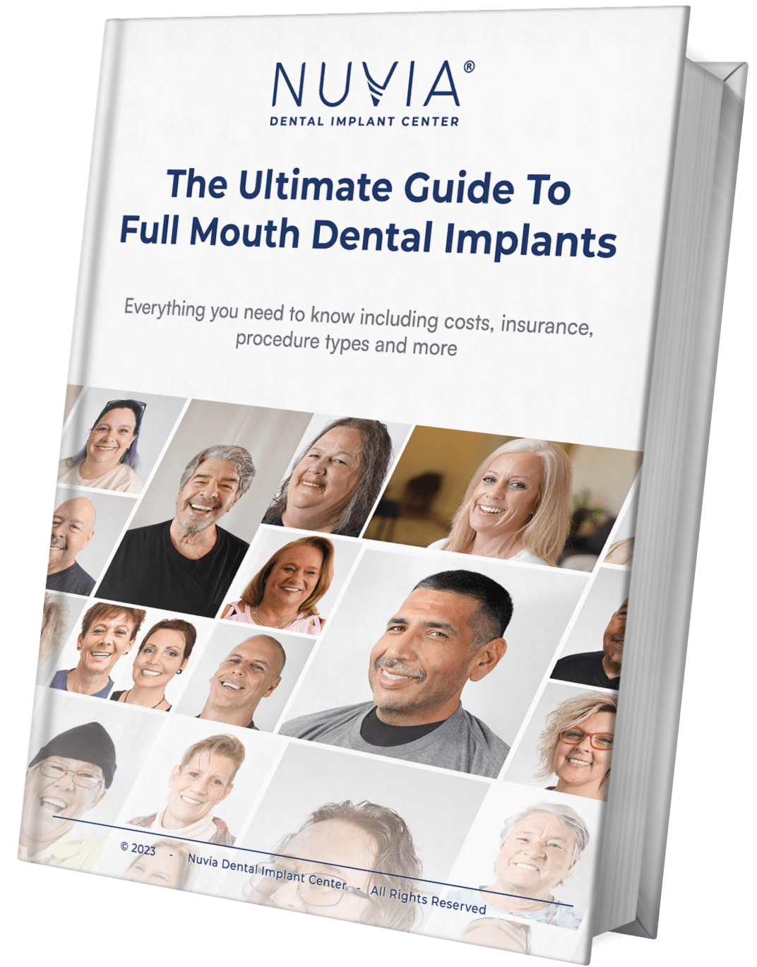 the-ultimate-guide-to-full-mouth-dental-implants-in-2023