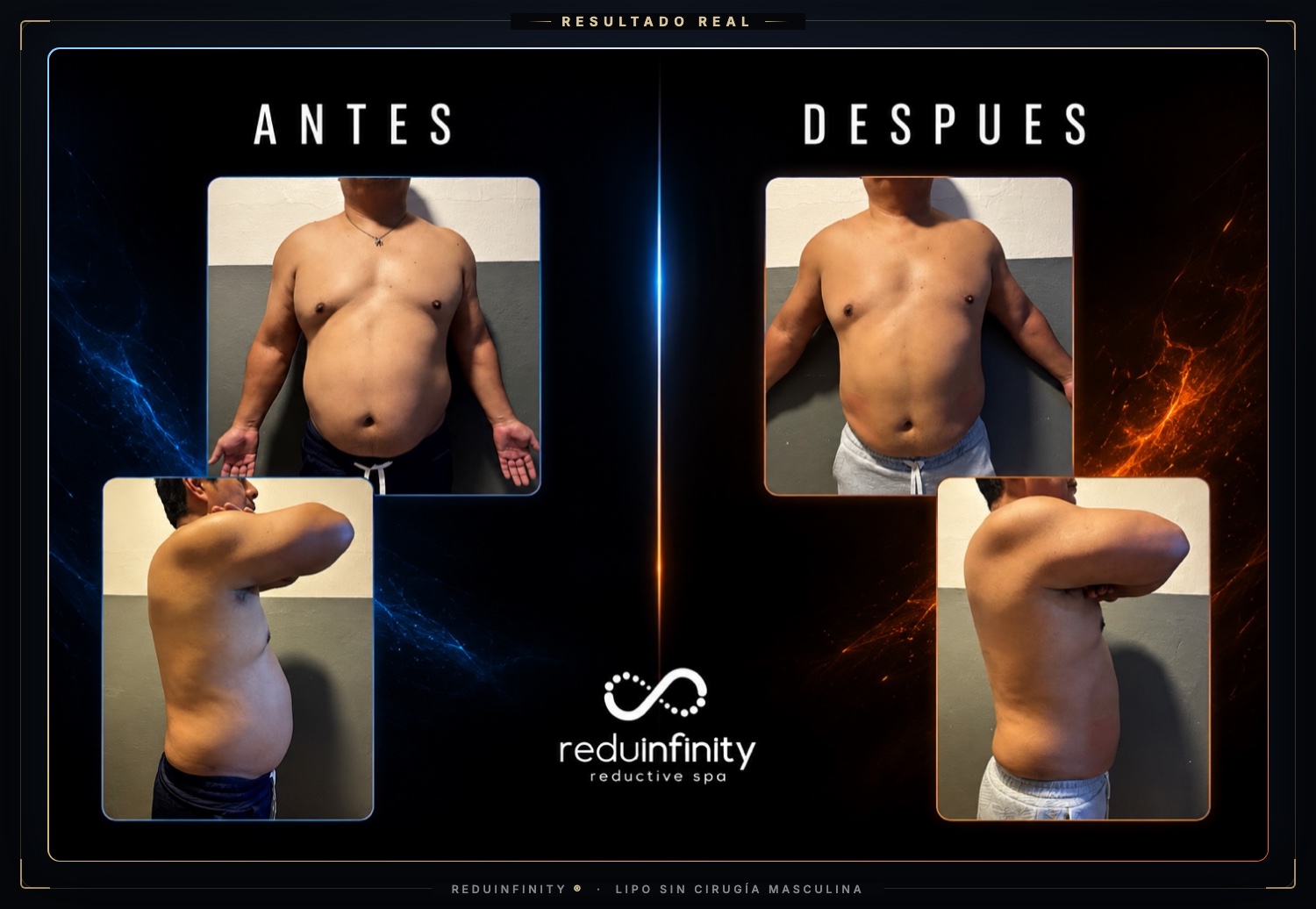 Antes y después real de un cliente de Reduinfinity