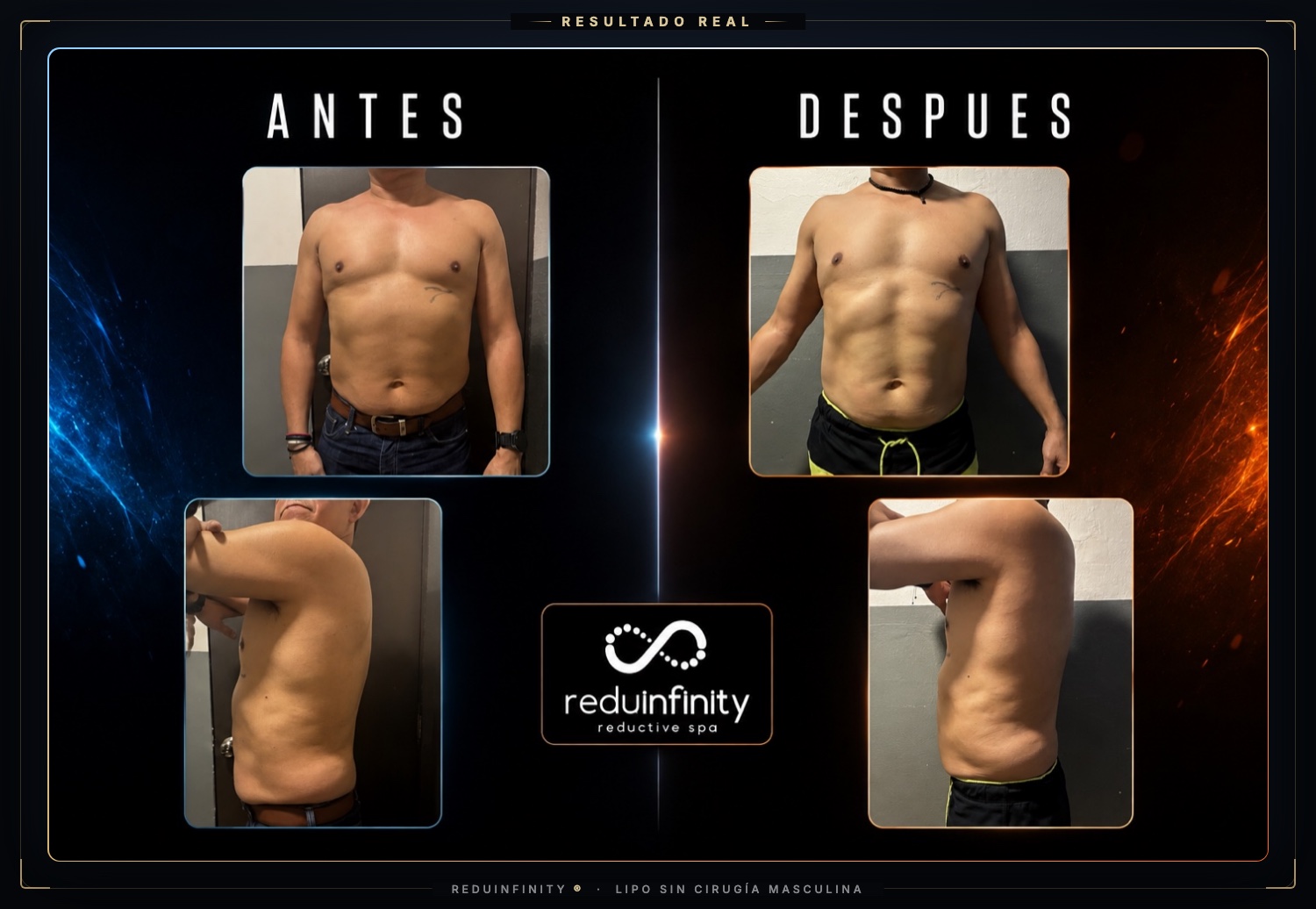 Antes y después real de un cliente de Reduinfinity