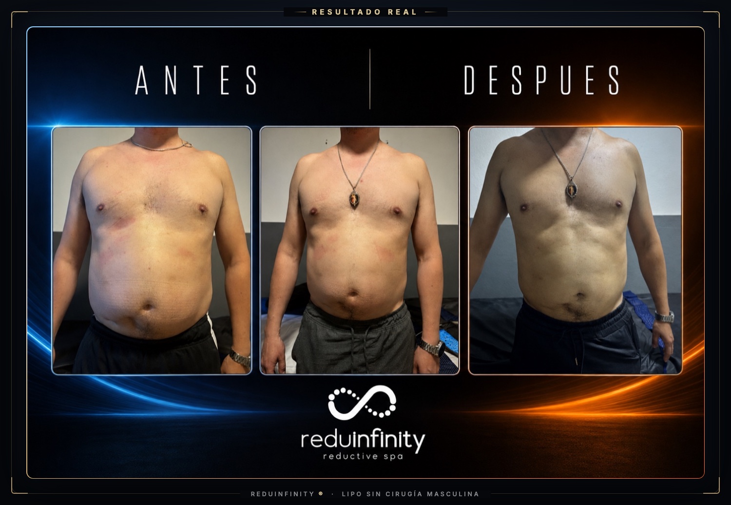 Antes y después real de un cliente de Reduinfinity