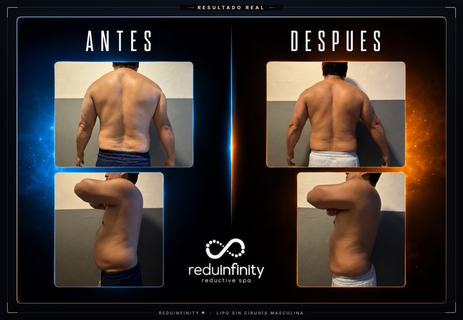 Antes y después real de un cliente de Reduinfinity