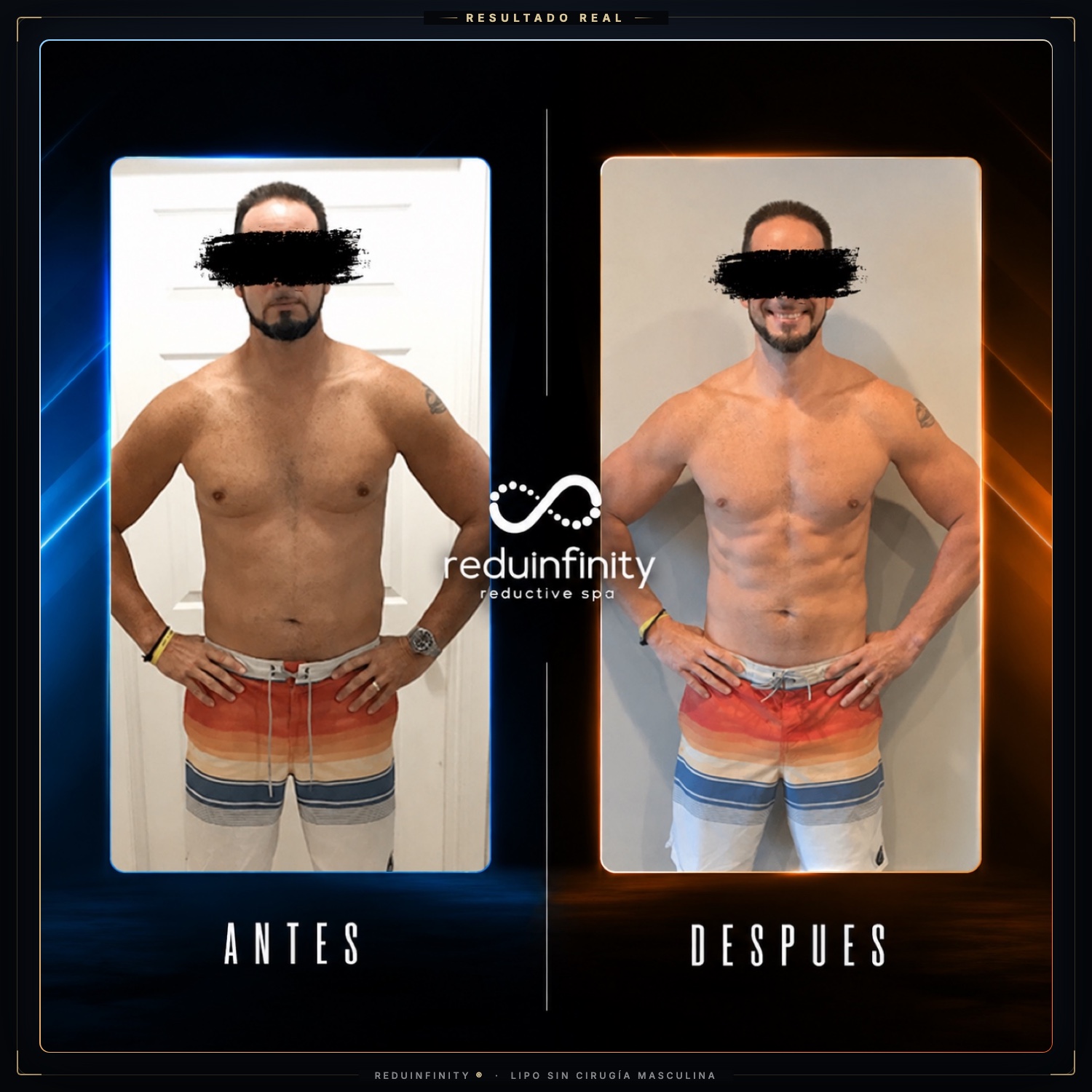 Antes y después real — cliente de Reduinfinity