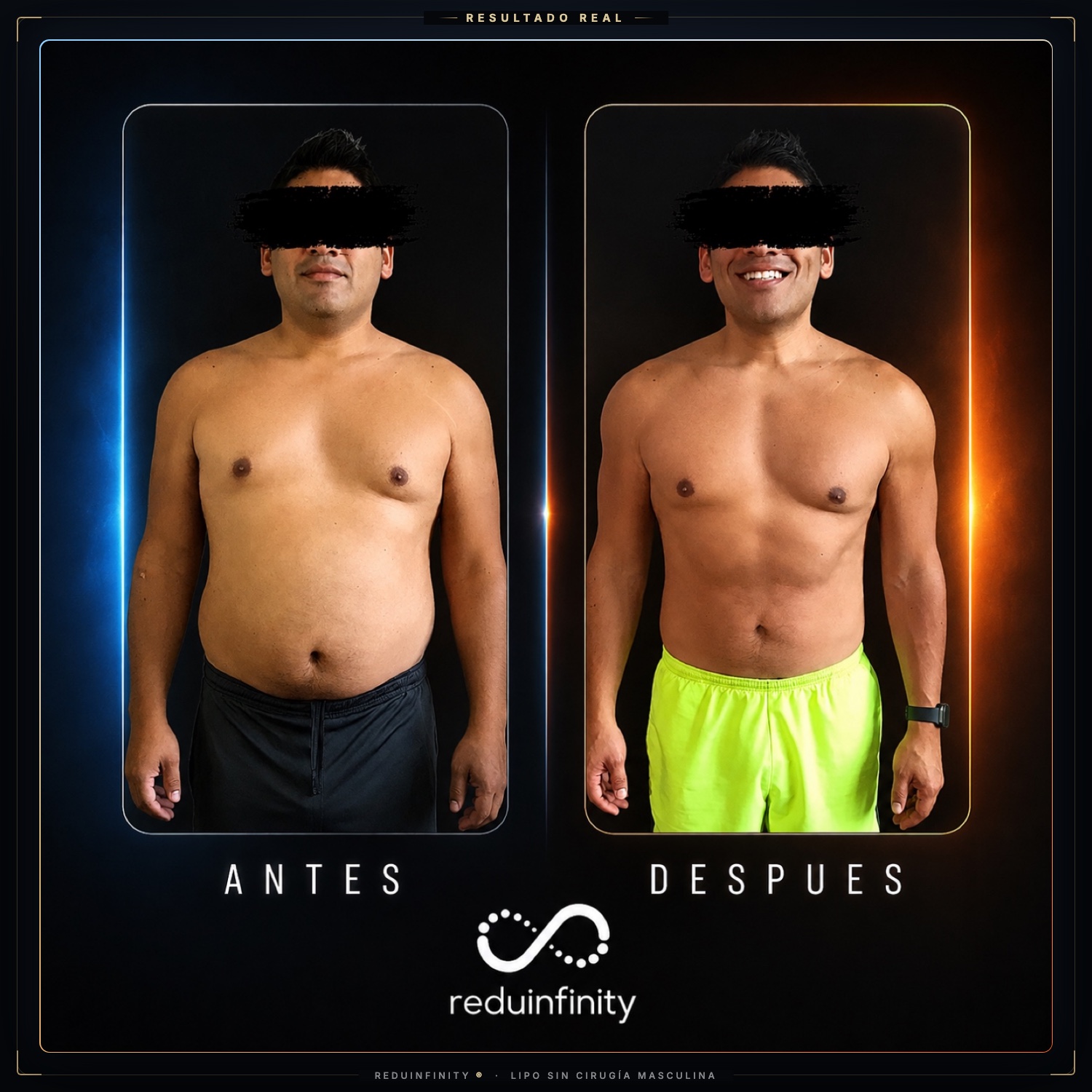 Antes y después real — cliente de Reduinfinity