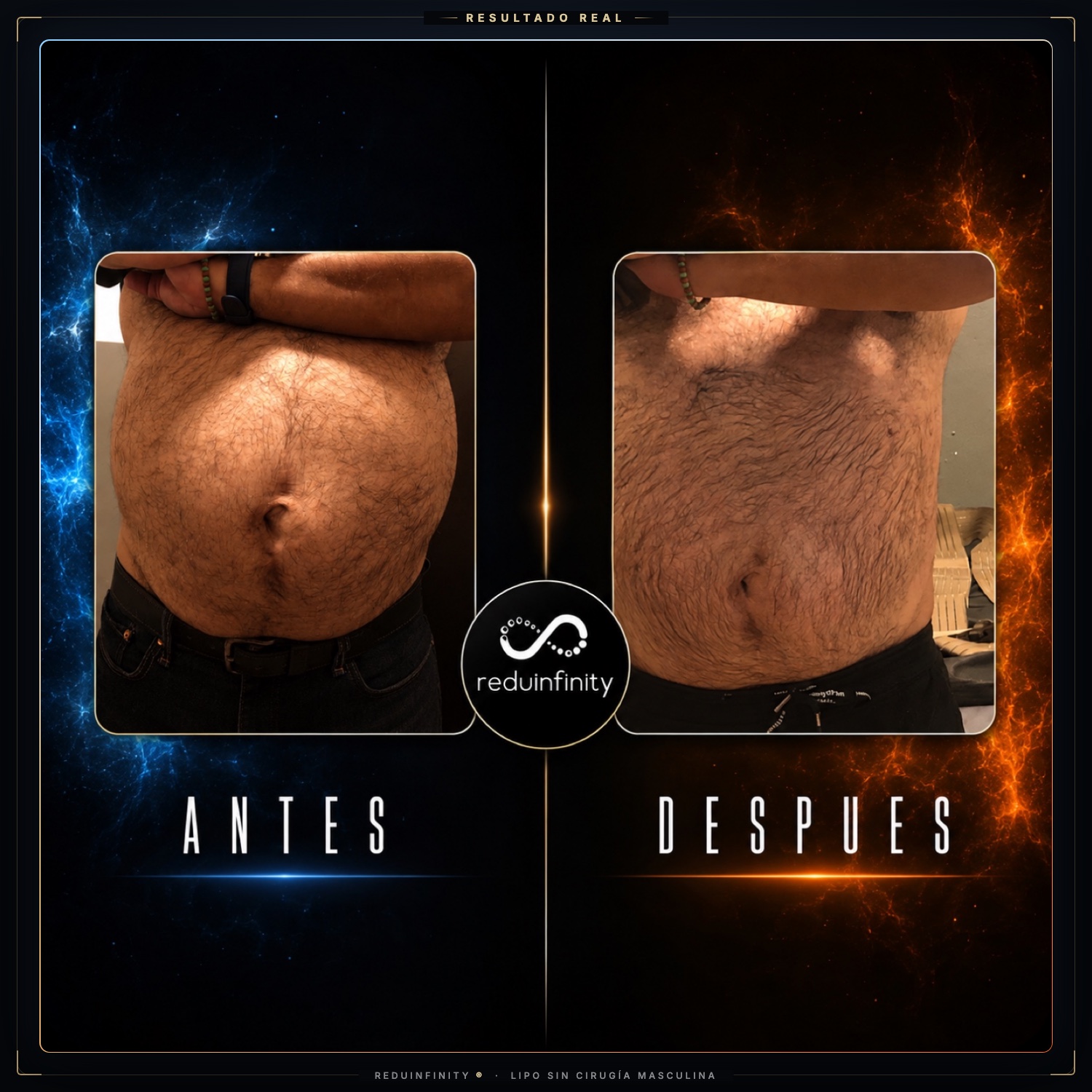 Antes y después real de un cliente de Reduinfinity