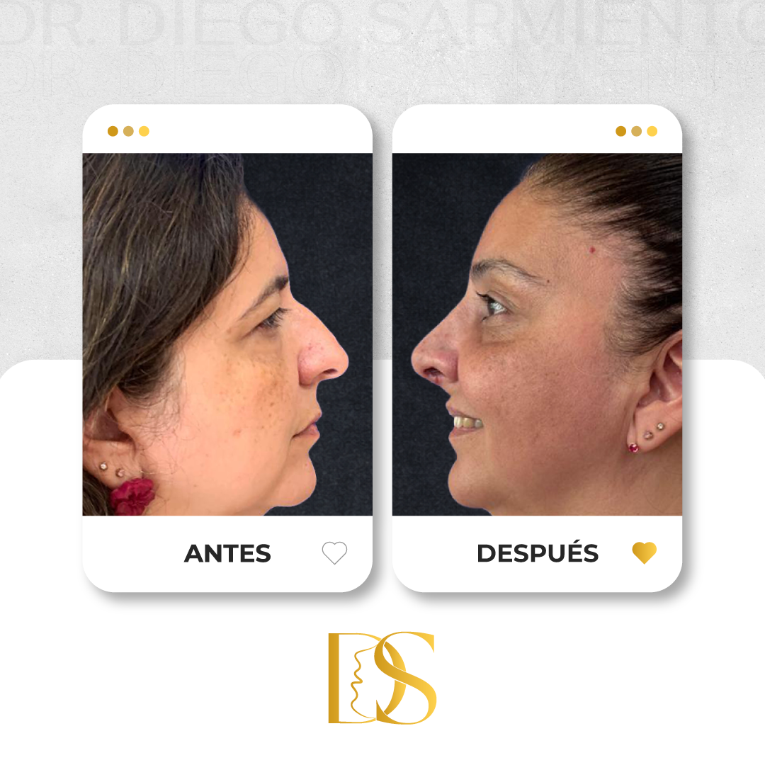 Resultado 1