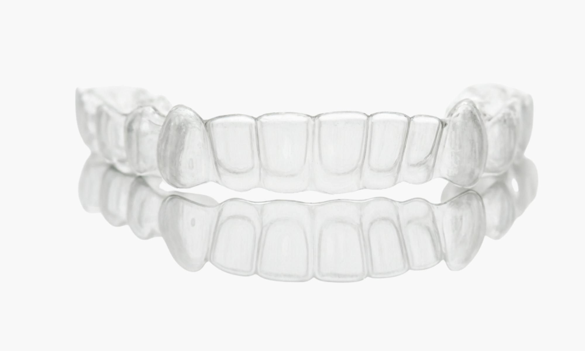 Patiente recevant des soins dentaires généraux à Genève – détartrage, traitement des caries et soins courants pour une bouche saine.