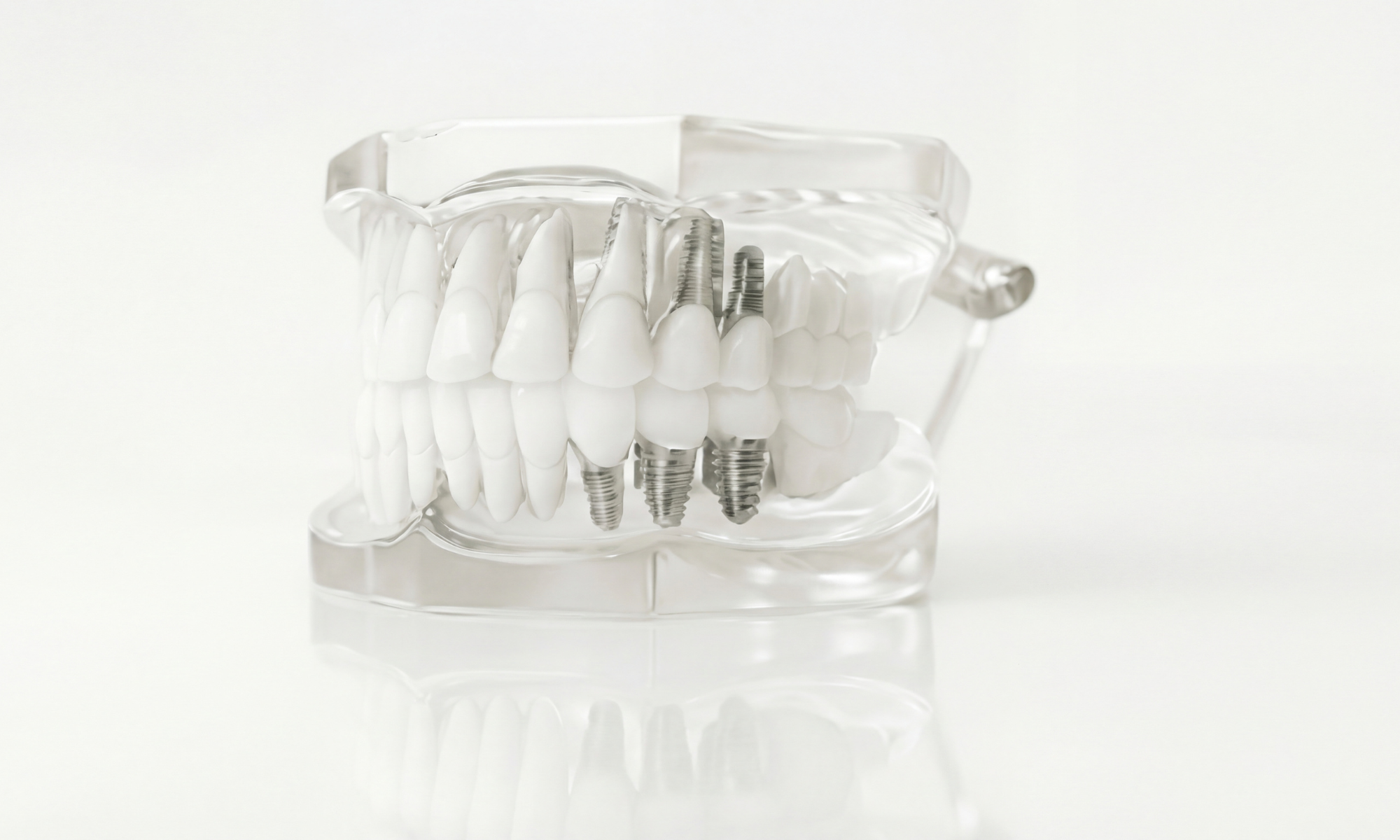 Instruments dentaires et schéma dentaire illustrant la préservation des tissus biologiques au Cabinet Dentaire Châtillon à Genève