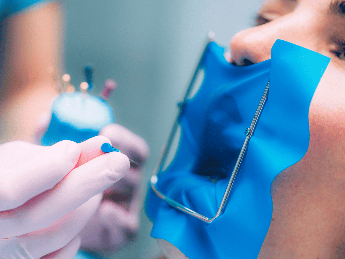 Close-up of tooth being treated with root canal procedure