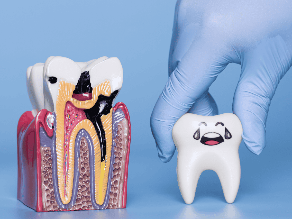 Dental professional cleaning infected root canals