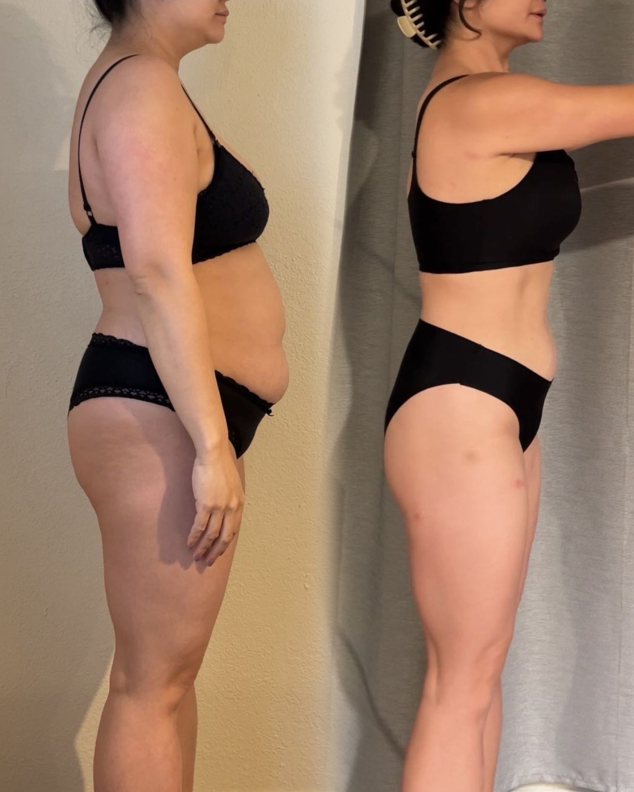 Transformation