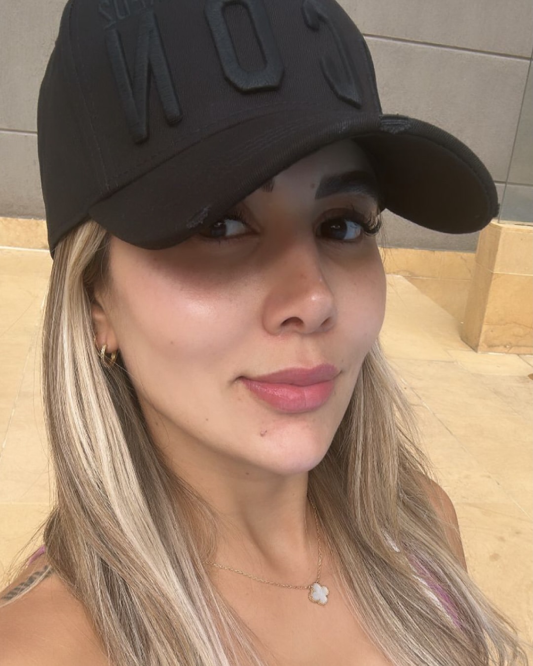 Paciente del Dr. Cardona, resultado de rinoplastia