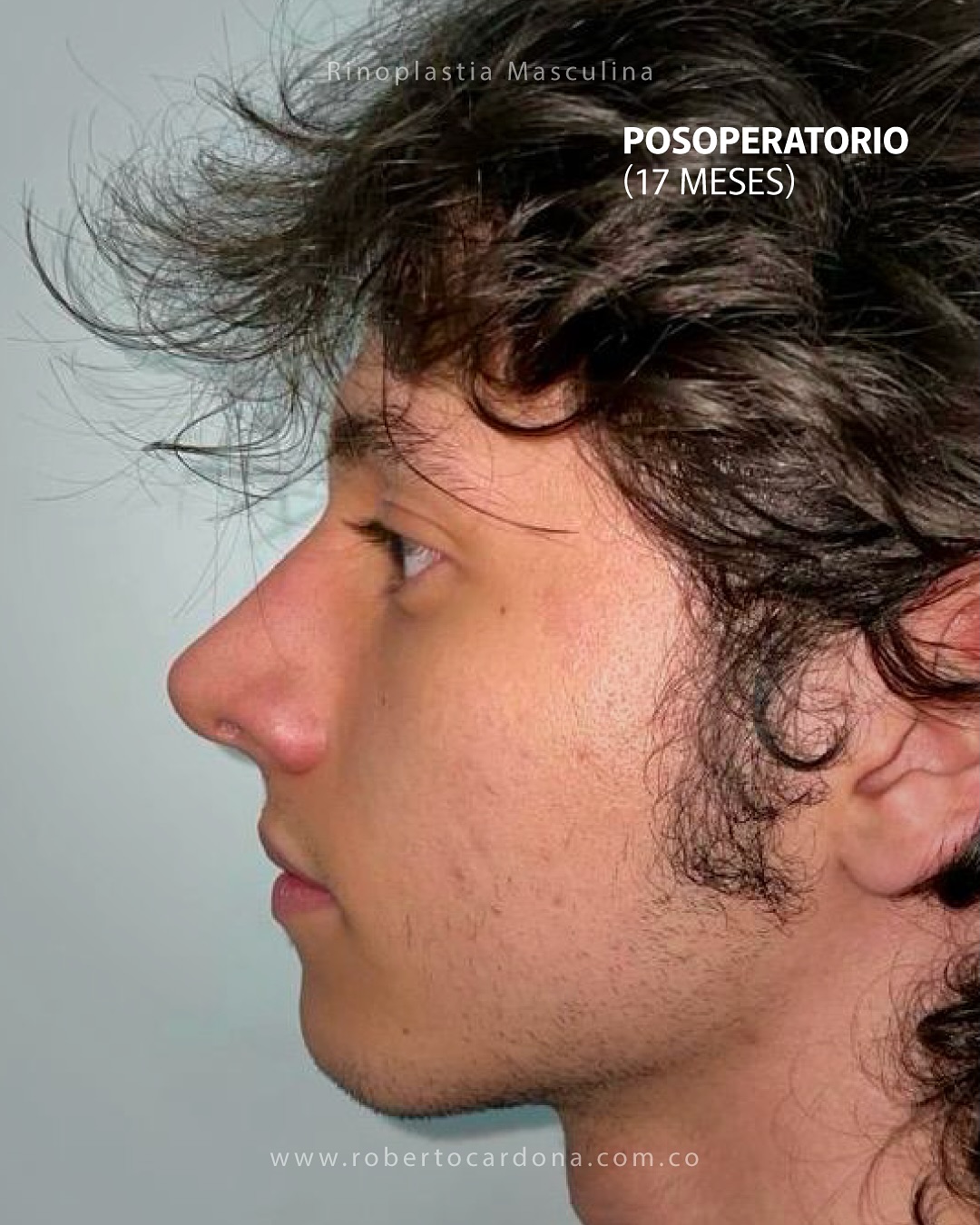 Caso documentado 08, foto 5 de 14