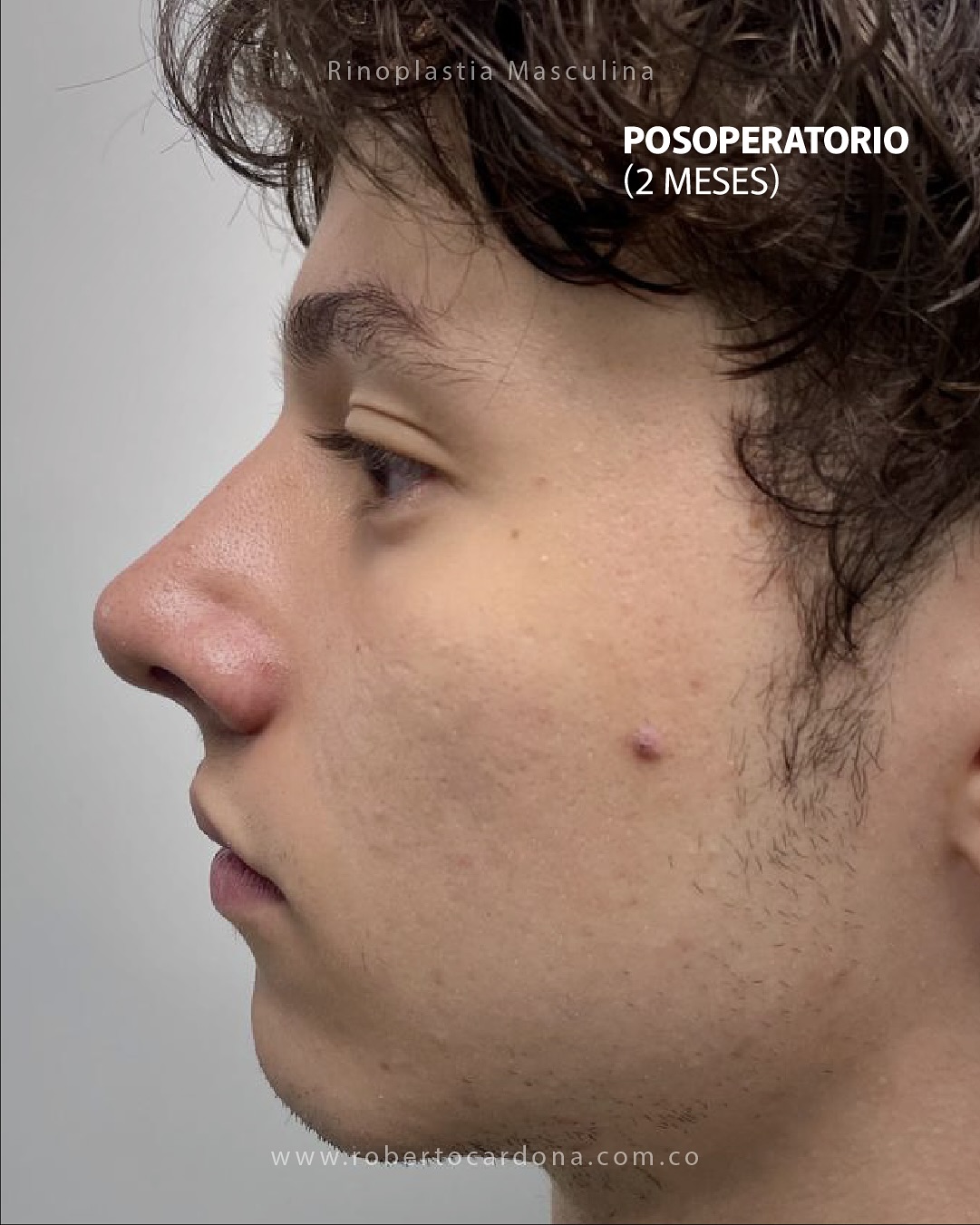 Caso documentado 08, foto 4 de 14