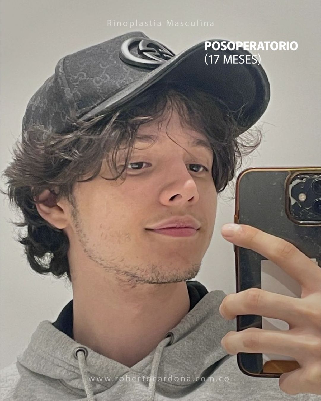 Caso documentado 08, foto 1 de 14