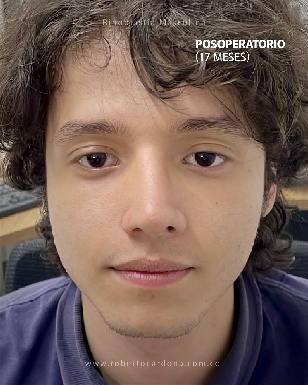 Caso documentado 08, foto 11 de 14