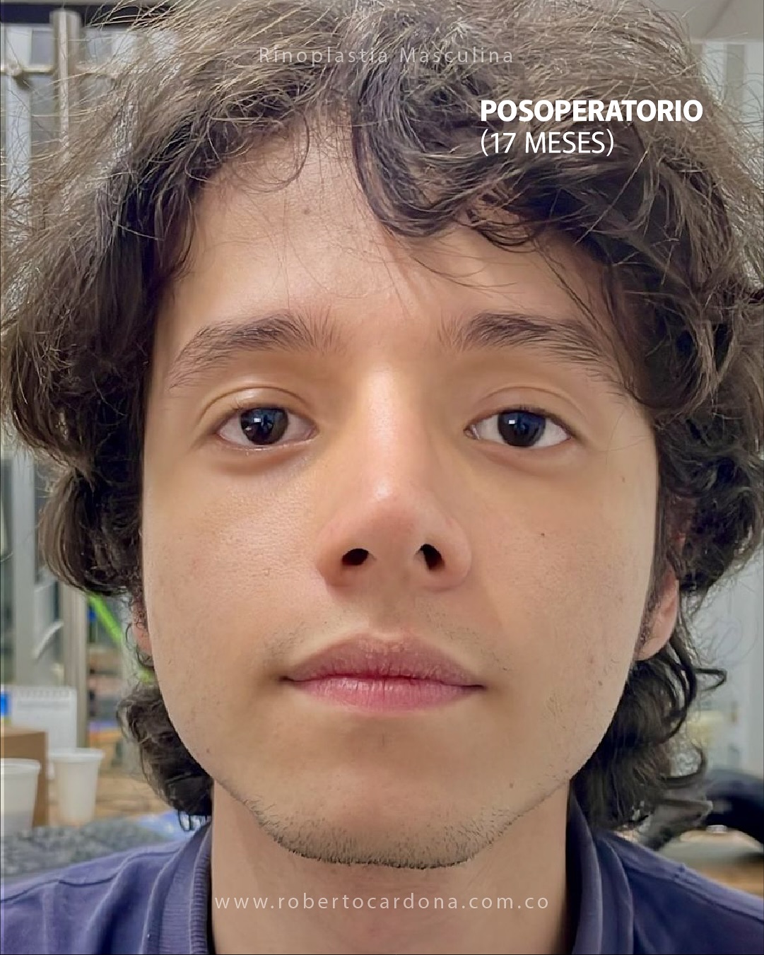 Caso documentado 08, foto 14 de 14