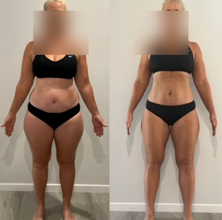 Noelle before and after