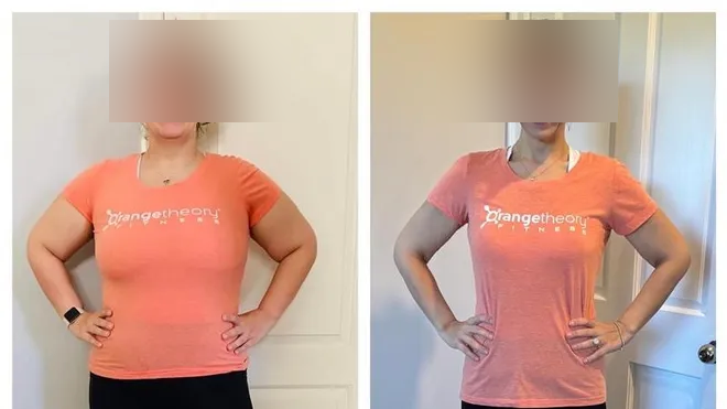 Janet before and after