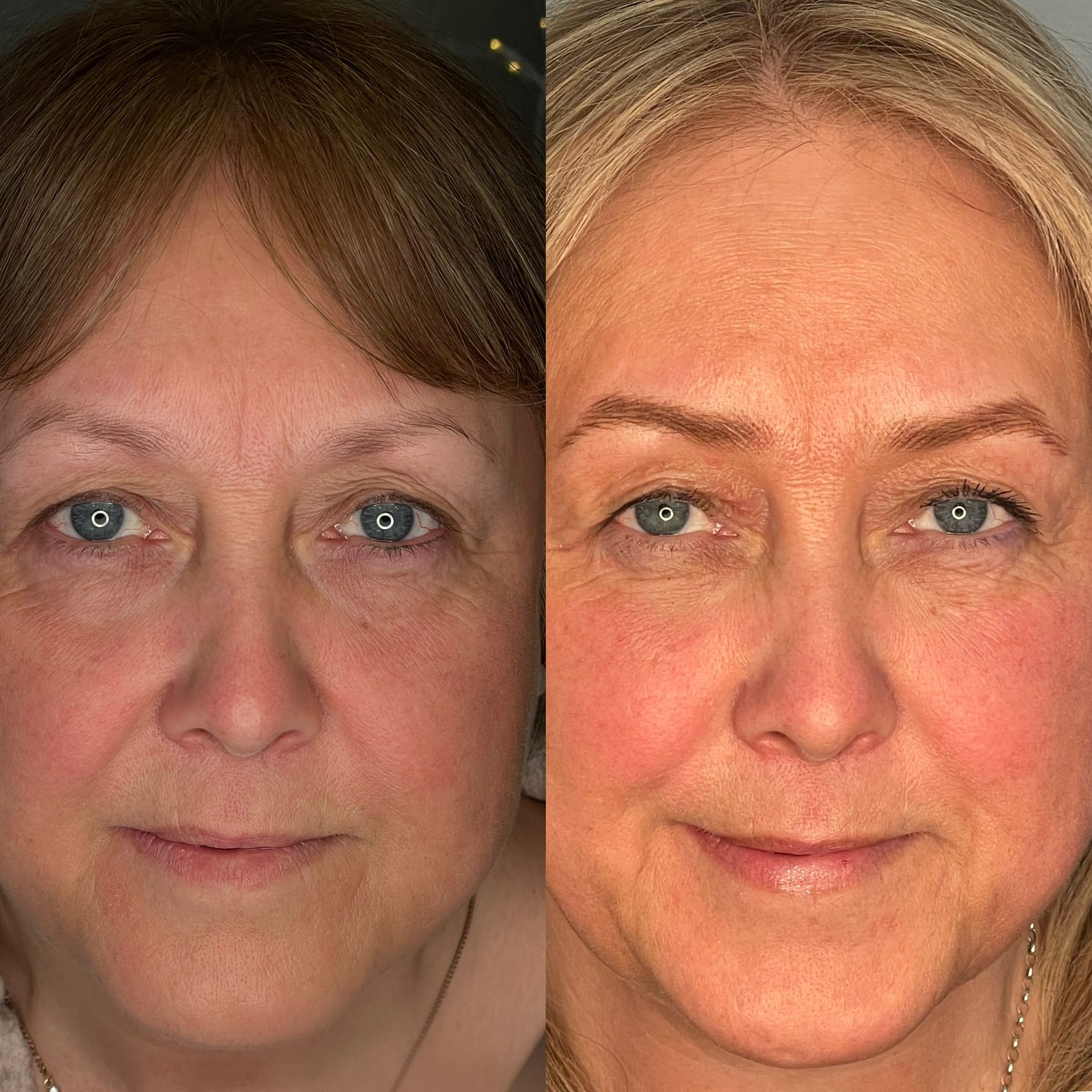 Före och efter
