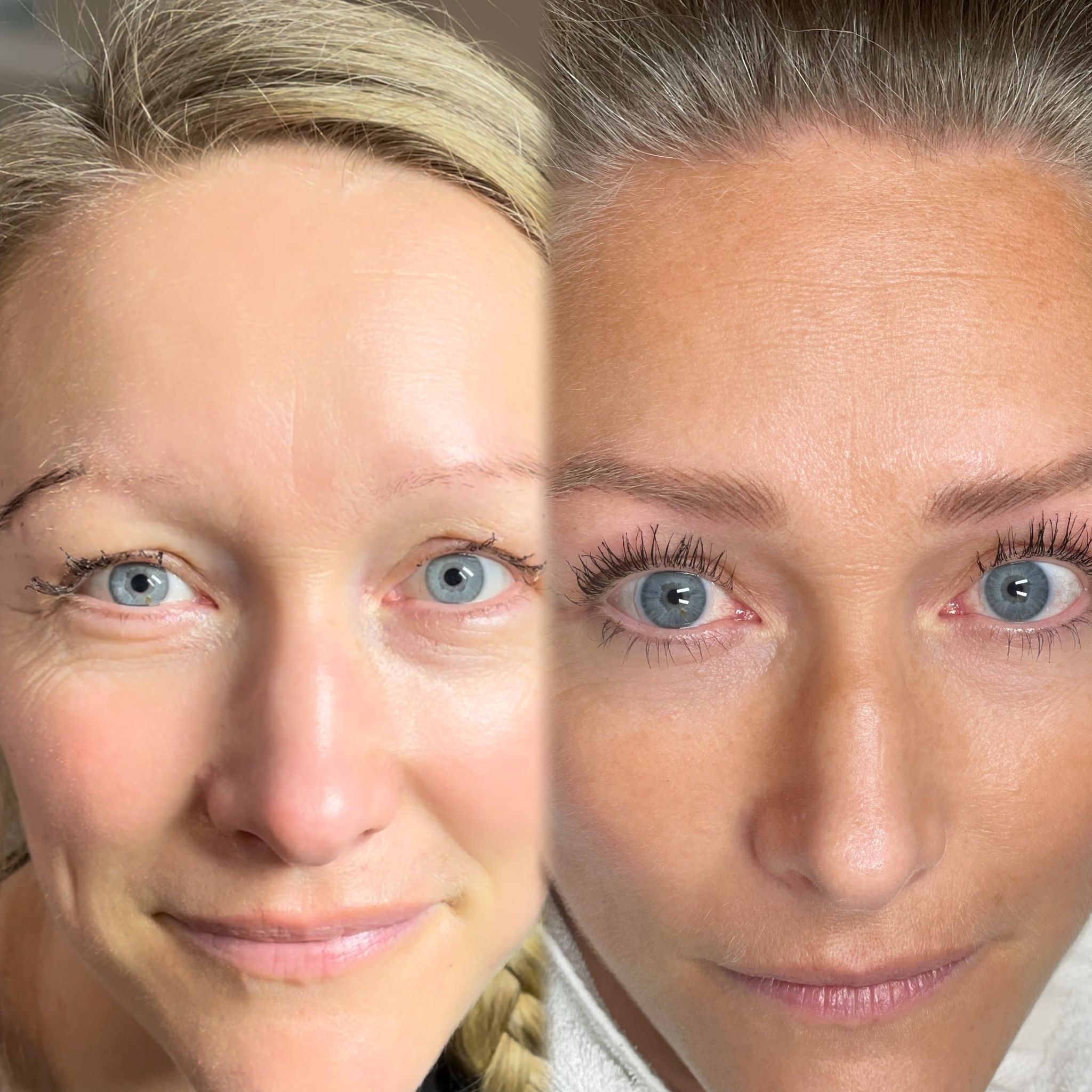 Före och efter