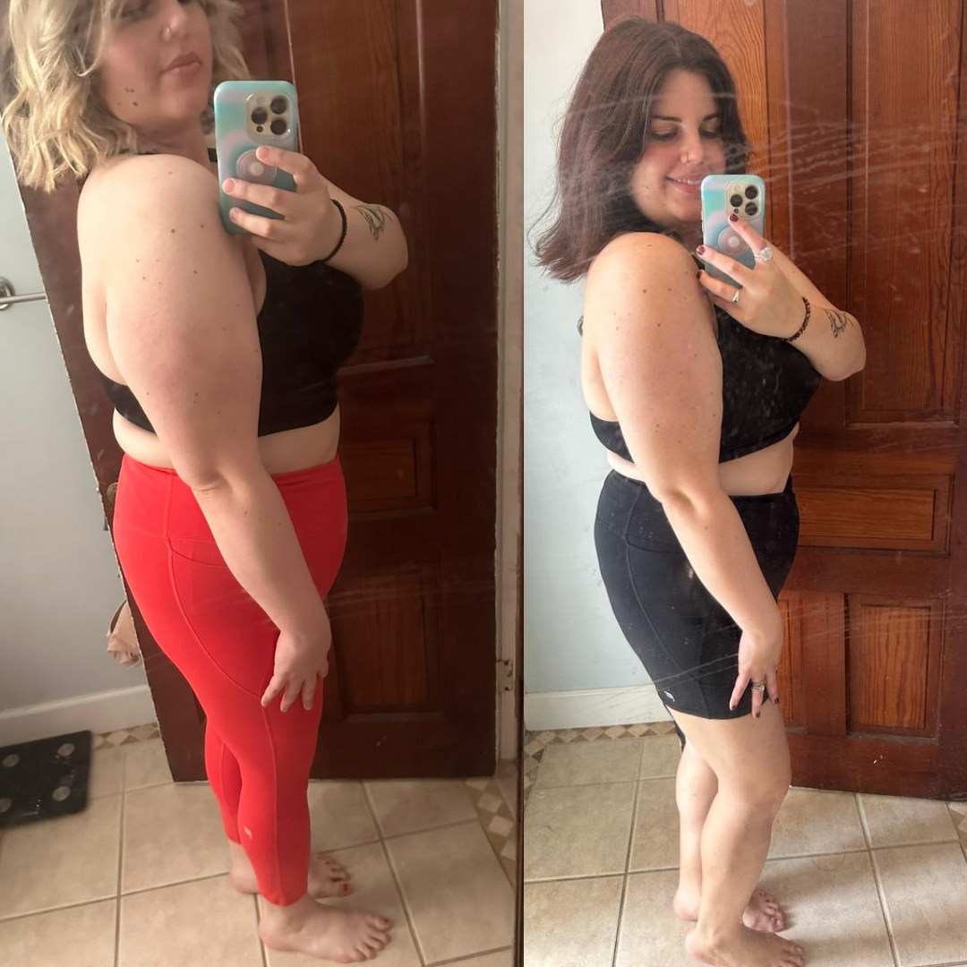 Ashley transformation image placeholder