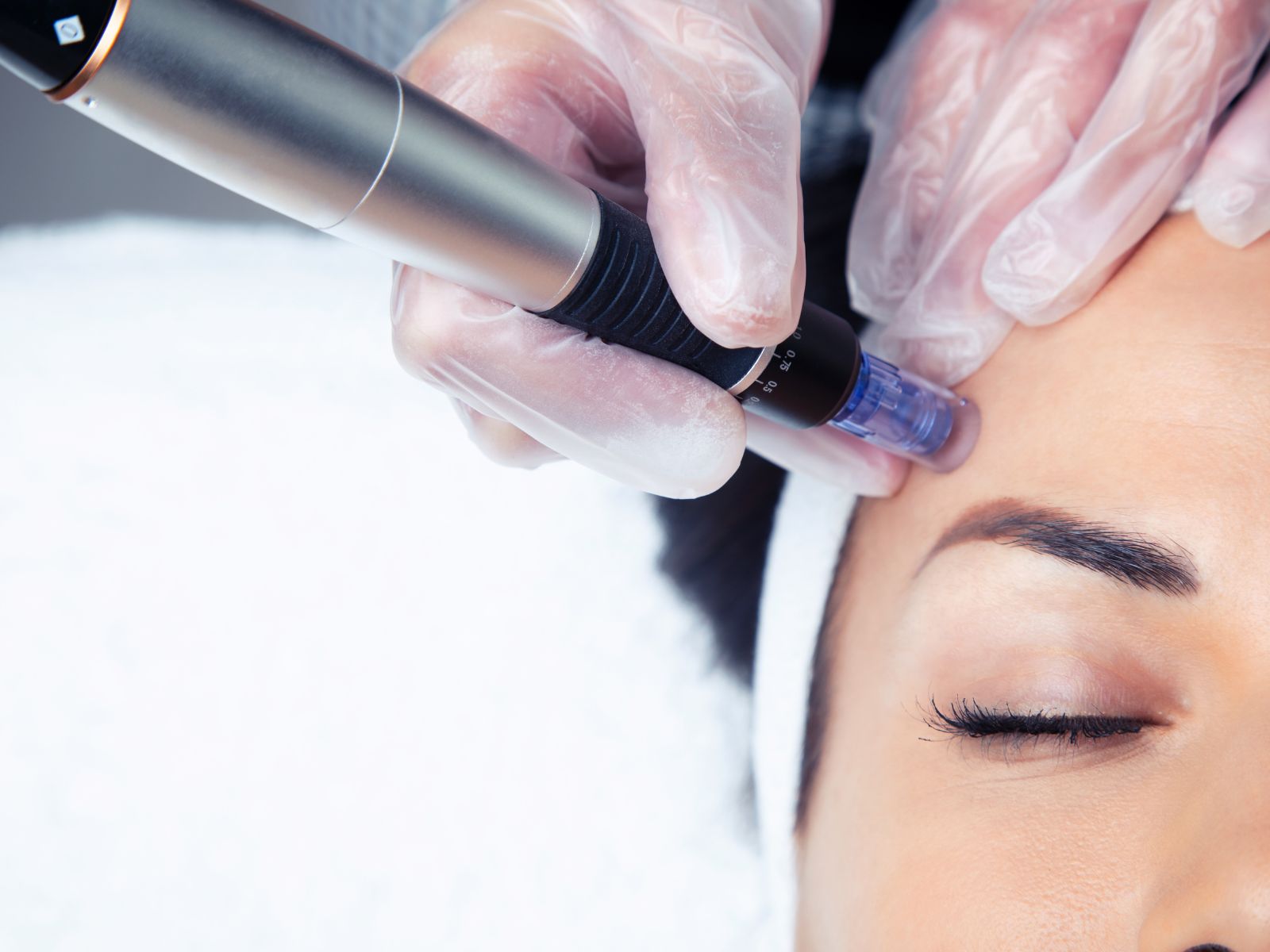 Haargroeistimulatie bij Healing Skin Clinic in Nuth