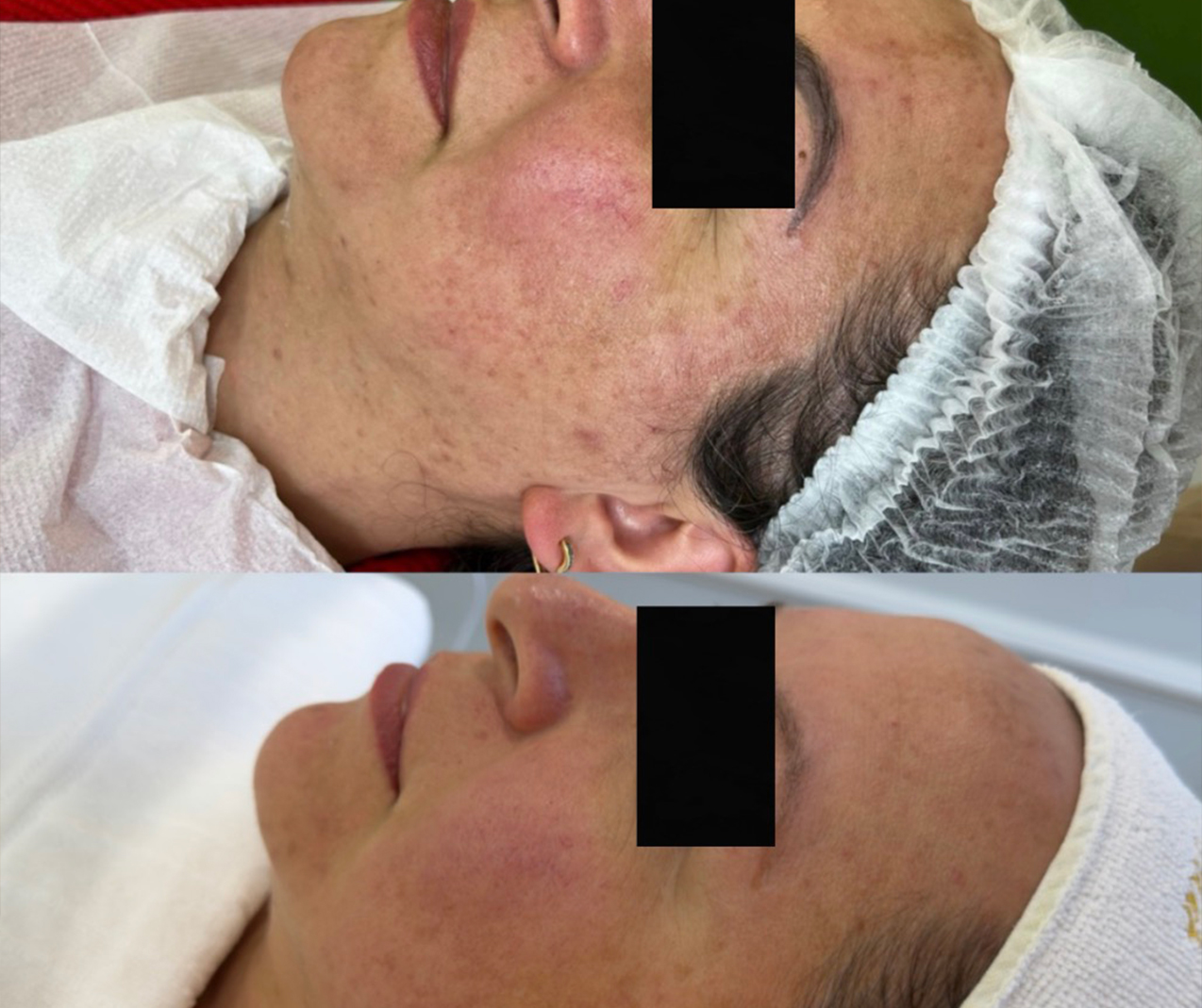 Comparativo clínico de antes e depois — resultado 3
