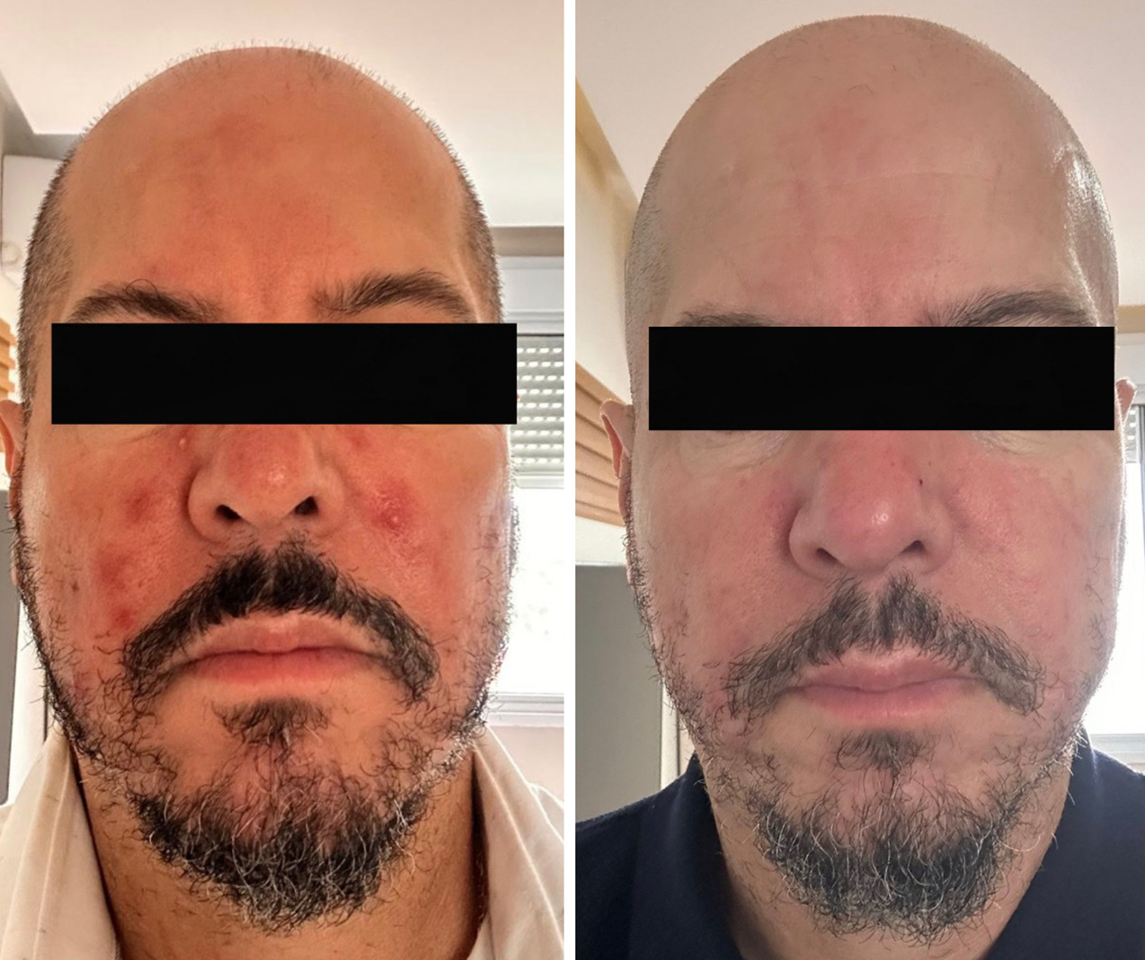 Comparativo clínico de antes e depois — resultado 5