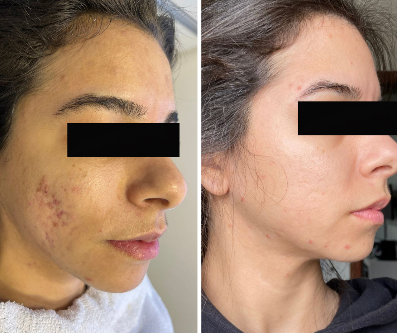 Comparativo clínico de antes e depois — resultado 4