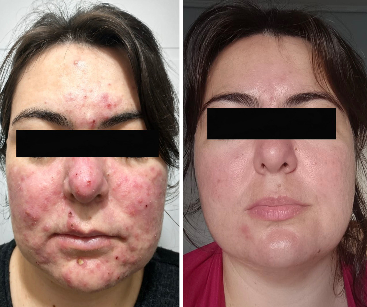 Comparativo clínico de antes e depois — resultado 7
