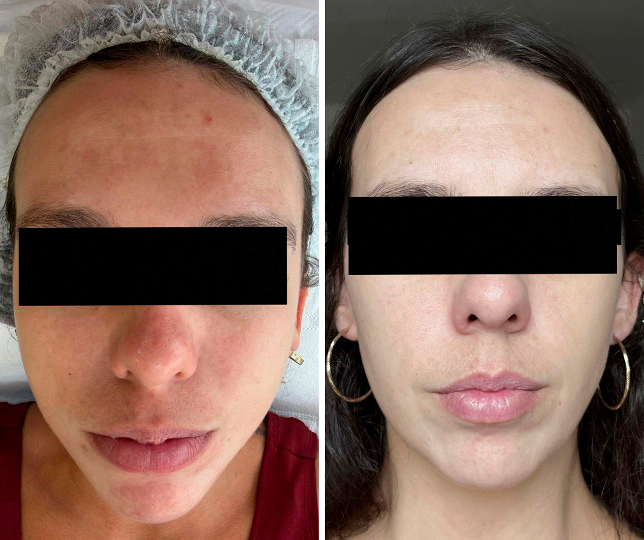 Comparativo clínico de antes e depois — resultado 8
