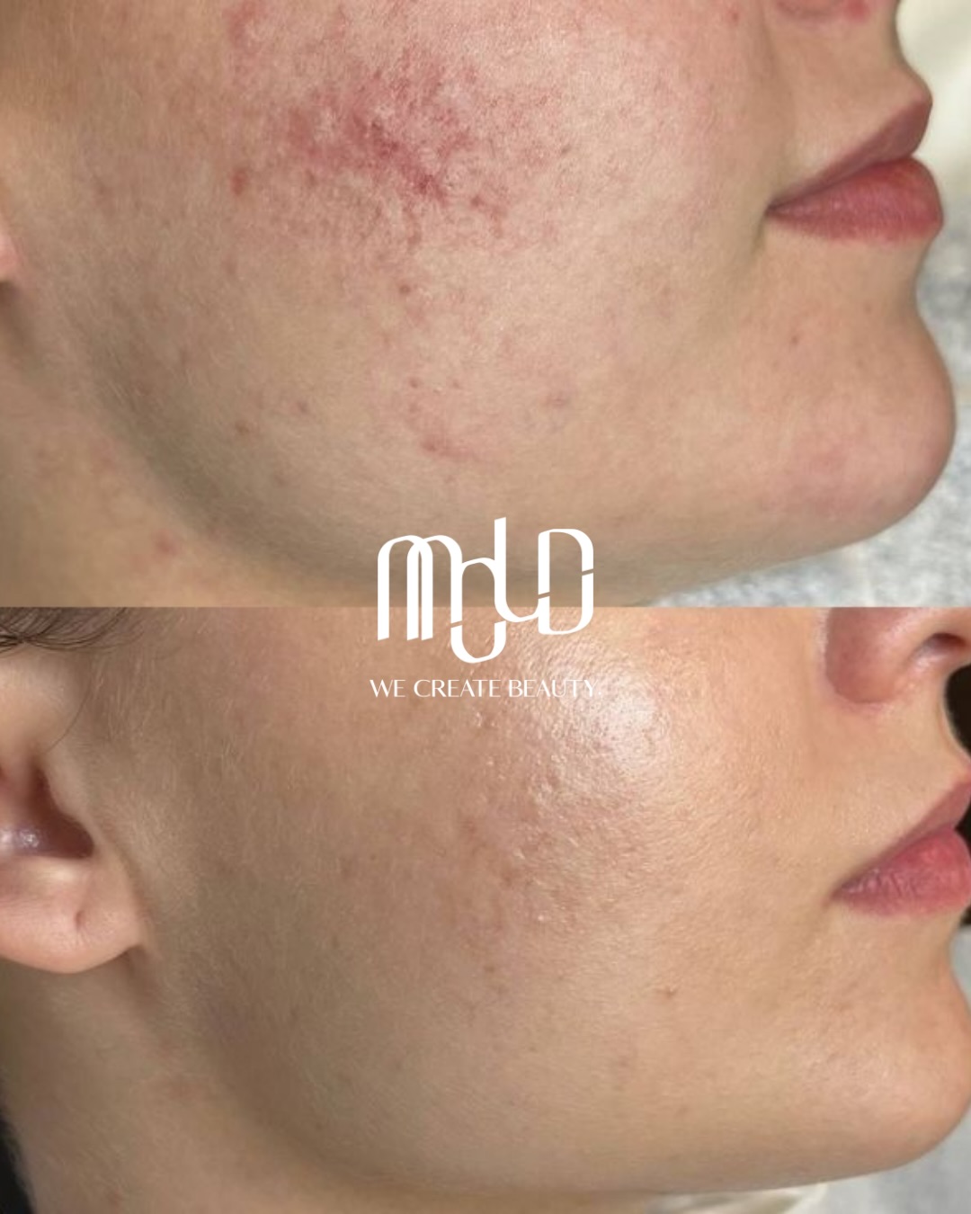 Why Aesthetic Procedures Are More Affordable in the Philippines