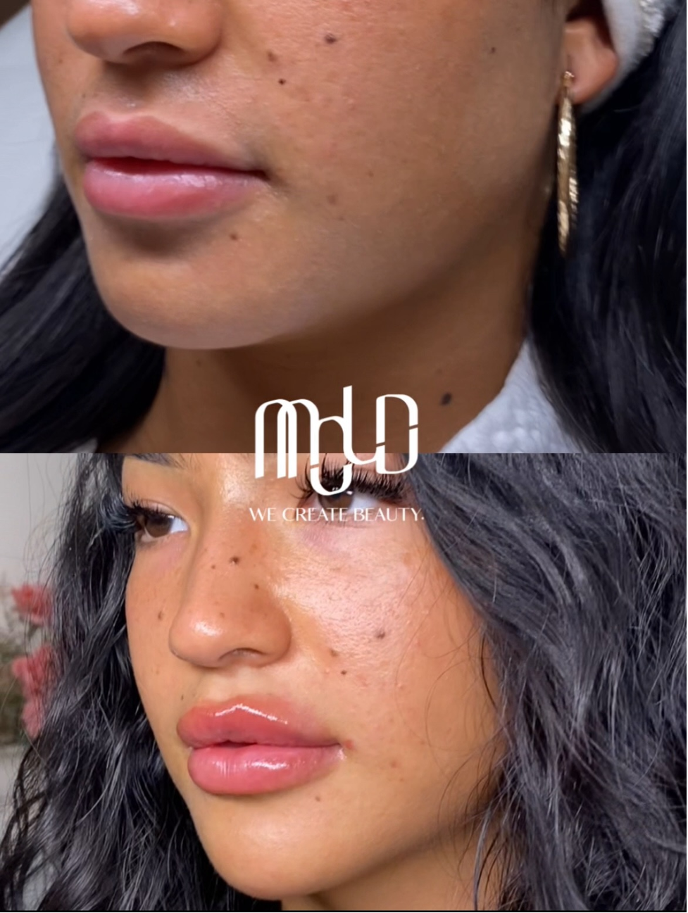 aesthetic procedures