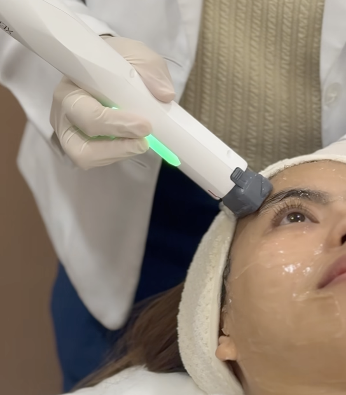 XERF’s dual-frequency RF technology helps stimulate collagen for firmer, smoother-looking skin. XERF’s dual-frequency RF technology helps stimulate collagen for firmer, smoother-looking skin.