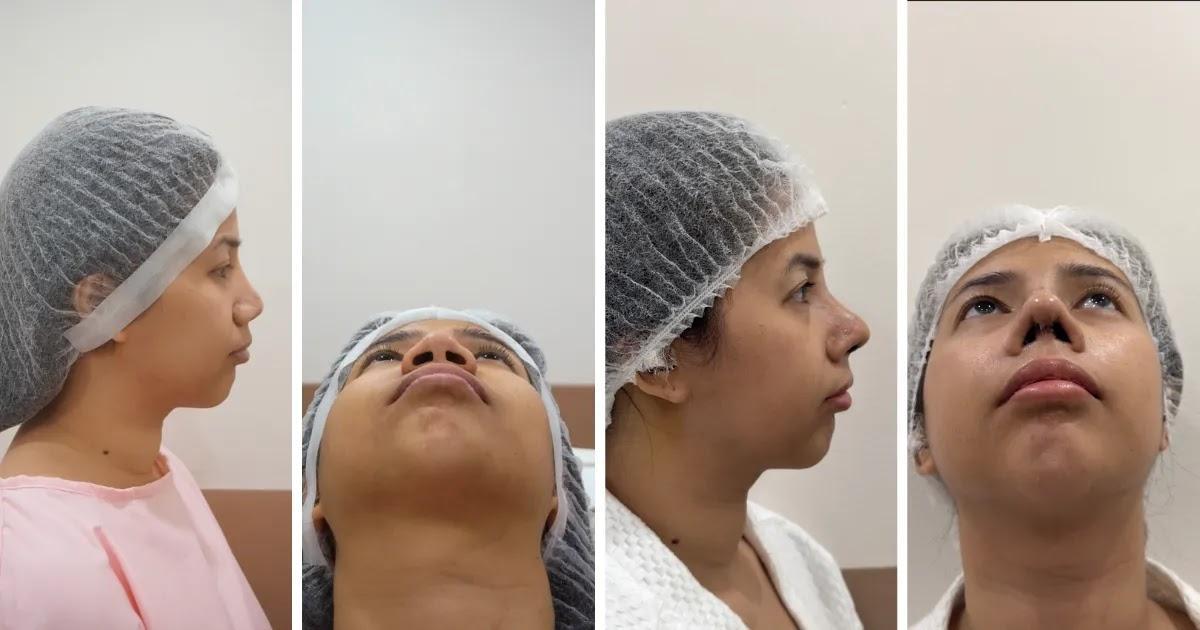 Post-operative assessment alongside a pre-operative reference image.