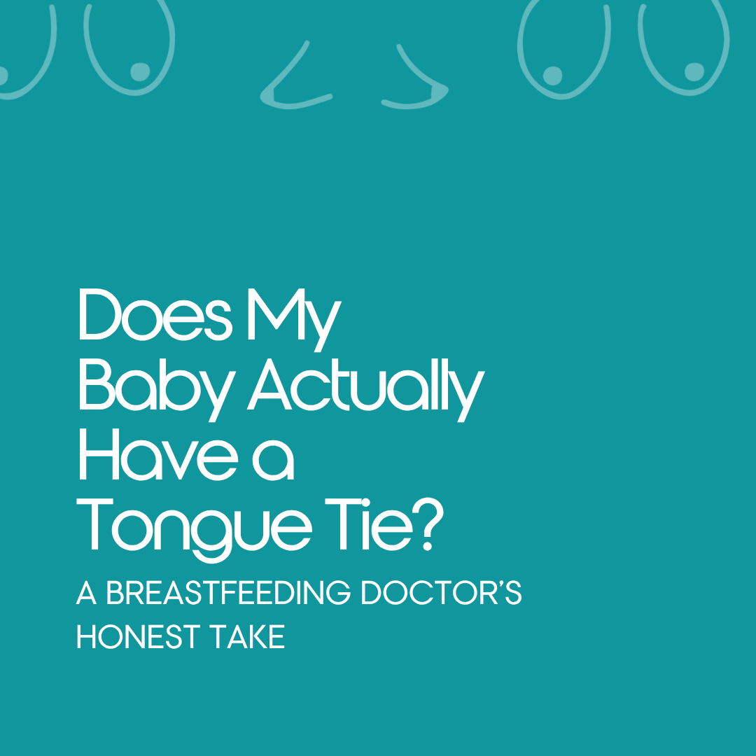 Does My Baby Actually Have a Tongue Tie? A Breastfeeding Doctor's Honest Take
