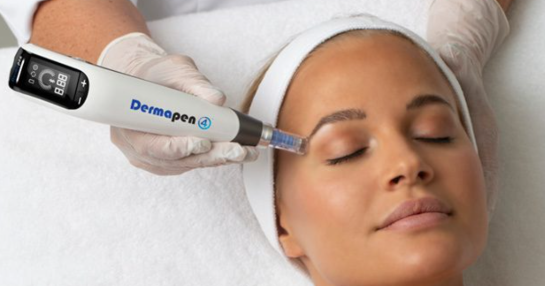 DermaPen4 skin needling treatment