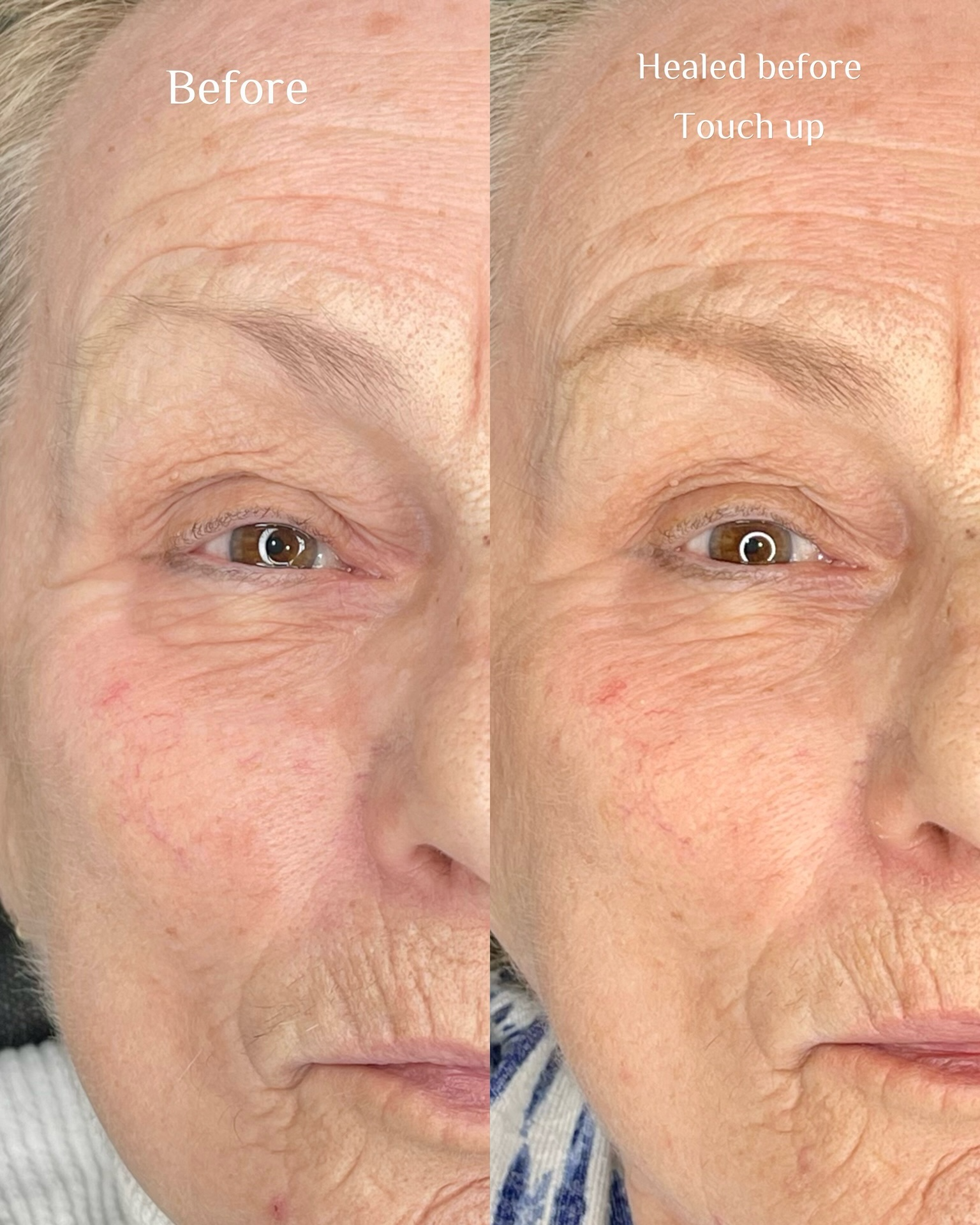 Before and after brow transformation 24